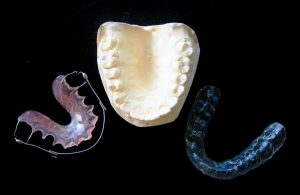 Fases ortodoncia